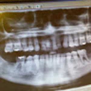 Meet your Posher, Leon